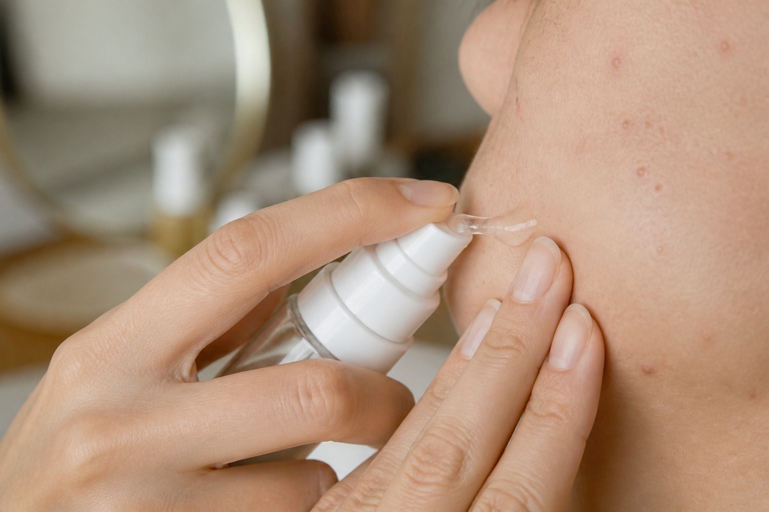 Manos aplicando gel desde un envase sin marca sobre la zona de la mejilla, sin mostrar el rostro.